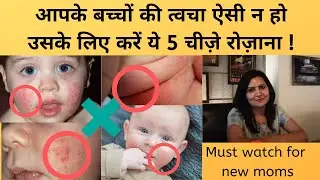 बच्चों की कोमल त्वचा के लिए देखभाल कैसे करें |How to take care of your baby skin |My Baby Care