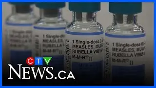 Low vaccination rates cause Canada to lose measles elimination status