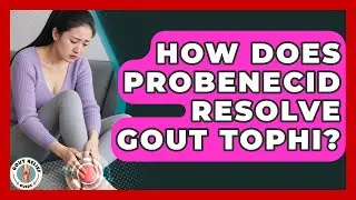 How Does Probenecid Resolve Gout Tophi? - Gout Relief Guide