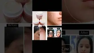 ✨Irani Mojza Cream Review🌸| Glowing Skin  Best Beauty Cream 💕#nightcream  #Iranimojzacream #GlowSkin
