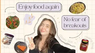 🥗 How to enjoy food again 🚫 without fearing acne/breakouts ✨| 💁🏼&zwj;♀️ How to eat for glowy skin 