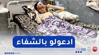 خنشلة :عادل شاب في ريعان شبابه نخر السرطان جسده و شوه وجهه