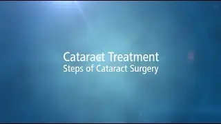 Cataract Surgery