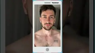 ftm transition journey #transman #ftm #shorts #tiktok