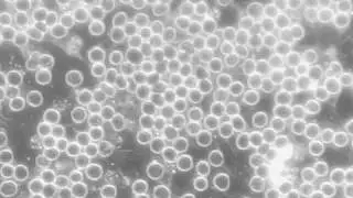 $3 microscope - destruction of blood cells because of too strong illumination