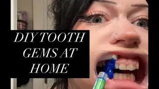 DIY Tooth Gems at Home