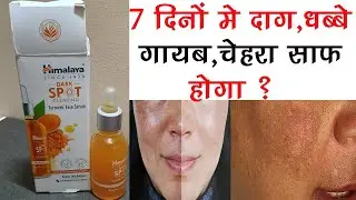 Himalaya Dark Spot Clearing Face Serum Turmeric | 7 दिन मे चेहरे के दाग,धब्बे दूर करे  |Pigmentation