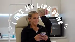I GOT MY LIPS DONE!!!