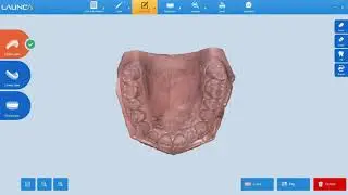 Launca training #16 - Introducing the function of HD photo and erase