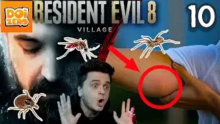 Mușcătura de insectă s-a umflat? Ai așa ceva? NU ignora simptomele astea! 💀 RE:Village ✅ EP 10