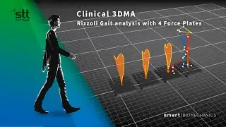 Rizzoli Gait analysis protocol with 4 Force Plates in Clinical 3DMA