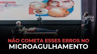 Erros que comprometem resultado facial em melasma