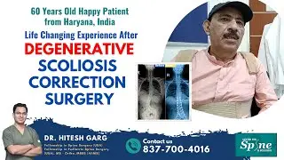 Walking Freely at 58: How Dr. Hitesh Garg Helped Om Kalra Overcome Scoliosis | स्कोलियोसिस सर्जरी