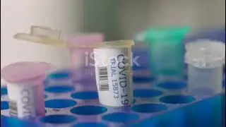 ODN Arogya Kendra &ndash; Viral Fever Test and Prevention