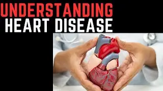 Stop Heart Disease Before It Strikes