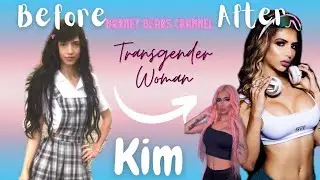 HRT BOY TO GIRL UPDATE TIMELINE/ MEET ONE OF THE MOST  BEAUTIFUL AND SEXY TRANSWOMAN /MS. KIM