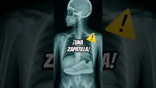 SE COMI&Oacute; UNA ZAPATILLA