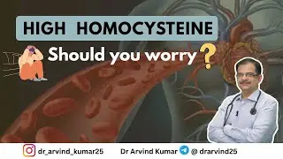 Causes and management of high homocysteine | Dr Arvind Kumar