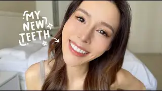 MY VENEER JOURNEY (Before and After + Q&A) | nicolechangmin