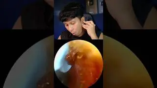 Barang Random : Pembersih Telinga Kamera