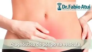 Diagnóstico do pólipo na vesícula - Por Dr. Fabio Atui 29/02/2016