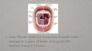 Jason Andor: Apple Cider Vinegar's Benefits
