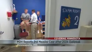 MDH reports 2nd measles case in 2025 following 2024 outbreak
