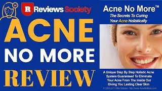Acne No More Review By Mike Walden
