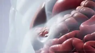 #medical animation surgery for crohn's disease, animation by pixeldust studios