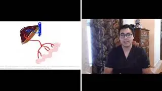 Malabsorcion Intestinal