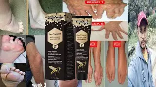 South Moon Bee Venom Melittin Joint Soothing Gel | Honest Review