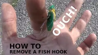 OUCH! How To Remove A FISHING HOOK In The Field - EASY FISH HOOK REMOVAL
