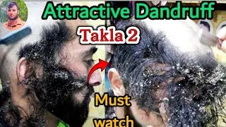 Head Shave 👉How To Attractive Dandruff Head Shave Tutorial For Men's 2026 head Shave bihari 