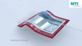 MTI&reg; hose   How it works in the resin infusion process