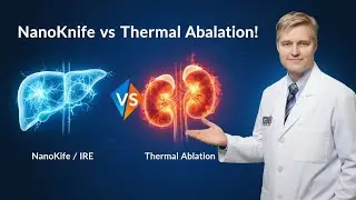 📱UroNurse Episode 182: How NanoKnife Differs from Thermal Ablation Techniques
