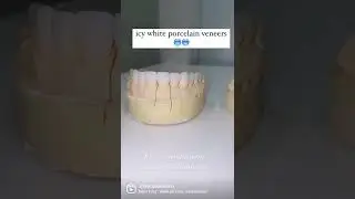 Icy White Porcelain Veneers