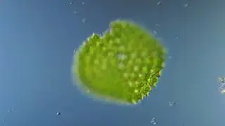 Pediastrum