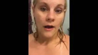 Acne treatment vapor rub day 2