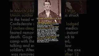 The Soldier Who Survived an Axe in His Skull 🪓⚡
