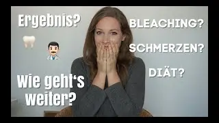 Zähne gebleicht?! Schmerzen?! Diät?! Ergebnis?! I Esther-Sarah