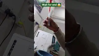 SGPT test 💫⚡l Result 😱 #short #ytshorts #labtechnician #labwork #viral #shortsfeed #trending #blood