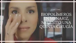 ME INYECTARON BIOPOL&Iacute;MEROS La historia de mi Nariz