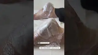 PediSpa | Soin des pieds callosit&eacute;s &bull;Avant/Apr&egrave;s #pedispa #PediSpa #SoinDesPieds #Callosit&eacute;s