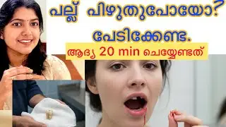 പല്ല് കൊഴിഞ്ഞു പുറത്ത് വന്നാൽ ആദ്യം ചെയ്യണ്ട കാര്യം @Devinevibez-q6n 