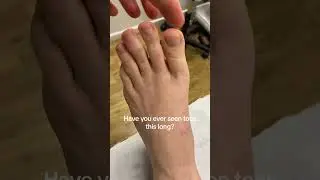 Unbelievably Long Toes: A Fascinating Foot Phenomenon #IncredibleFeet #MustSee