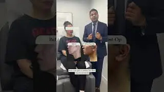 *Why our Deep Plane Facelift?* ✔️ *Awake technique* &ndash; No general anesthesia needed