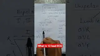 Значение 12-канальной ЭКГ, часть 1