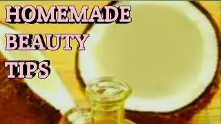 TOP 6 BEST REMEDIES AT HOME FOR RED/ITCHY EYES | MC ANTOINE