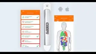 RADOTECH - ПРИБОР ДЛЯ ПЕРСОНАЛЬНОГО МОНИТОРИНГА ЗДОРОВЬЯ.