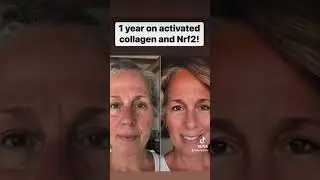 Liquid Collagen!  